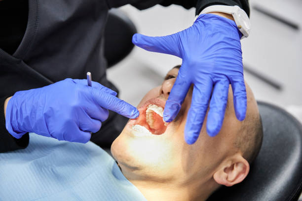 Best Emergency Dentist for Knocked-Out Tooth in Tokeneke, CT